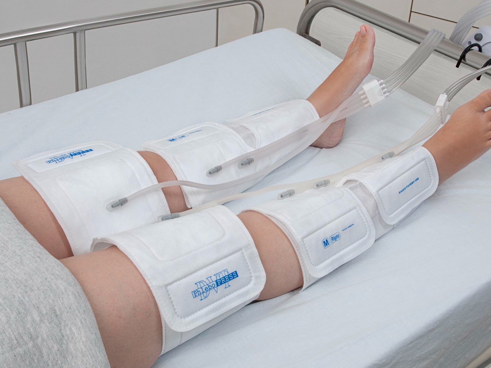 Intermittent Pneumatic Compression to Reduce the Risk of Venous
